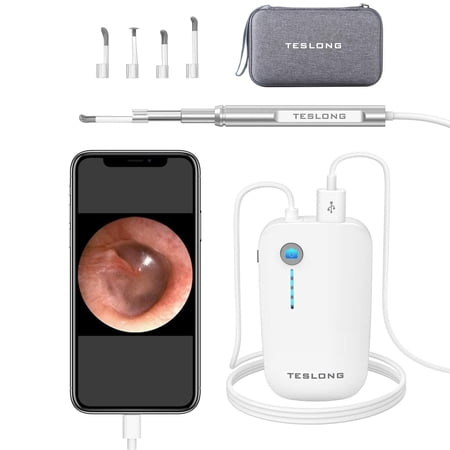Teslong Ear Wax Removal Tools, 720P HD Ear Camera, NTE100i Otoscope, Ear Cleaning Camera with 6 Adjustable LED Lights, Compatible with iPhone & Android, Easy to Use for Kids/Adults/Pet