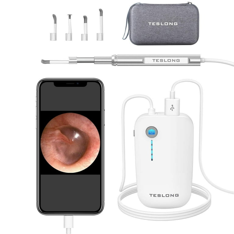 Teslong Ear Wax Removal Tools, 720P HD Ear Camera, NTE100i Otoscope, Ear  Cleaning Camera with 6 Adjustable LED Lights, Compatible with iPhone &  Android, Easy to Use for Kids/Adults/Pet 