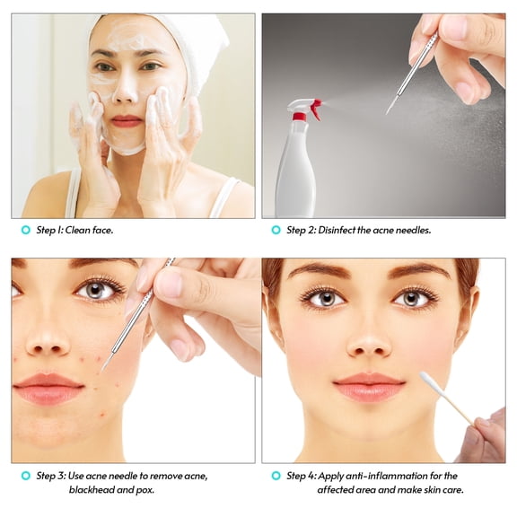 Thalyn Blackhead Remover Comedone Extractor Remover Blackhead Remover Pimple Popper Tool Kit for Pimple Blemish Comedone Acne Zit Whitehead Face Chin Forehead Cheek Body