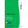 thumbnail image 1 of Pre-Owned Lung Cancer: The Facts The ^AFacts Series Paperback Stephen Falk, Williams, 1 of 1