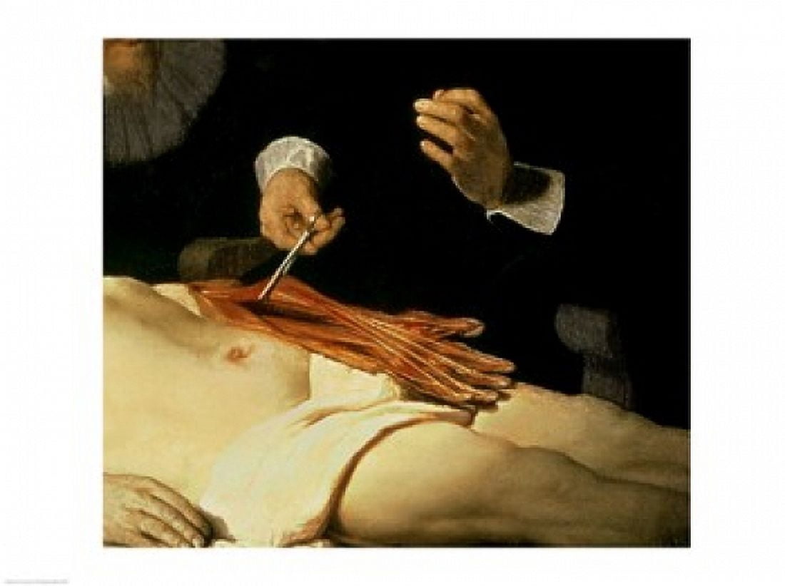 The Anatomy Lesson of Dr Nicolaes Tulp 1632 Canvas Art - Rembrandt van Rijn (24 x 18)