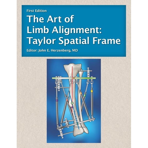 The Art of Limb Alignment (Paperback)