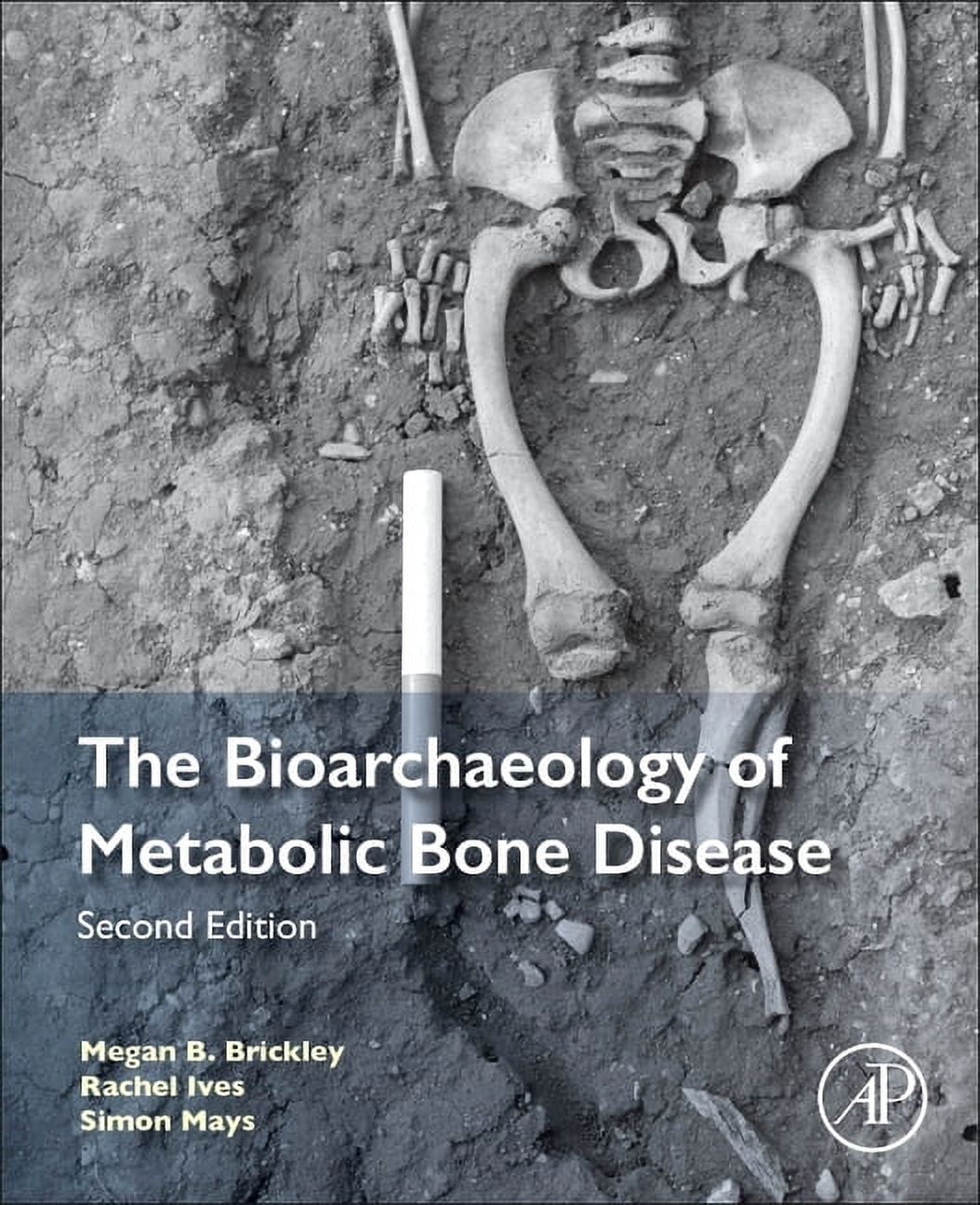 The Bioarchaeology of Metabolic Bone Disease, (Paperback) - Walmart.com