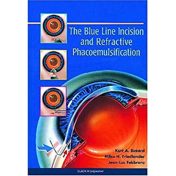 Pre-Owned The Blue Line Incision and Refractive Phacoemulsification 9781556424816 /