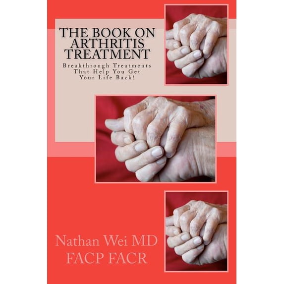 The Book on Arthritis Treatment, (Paperback)