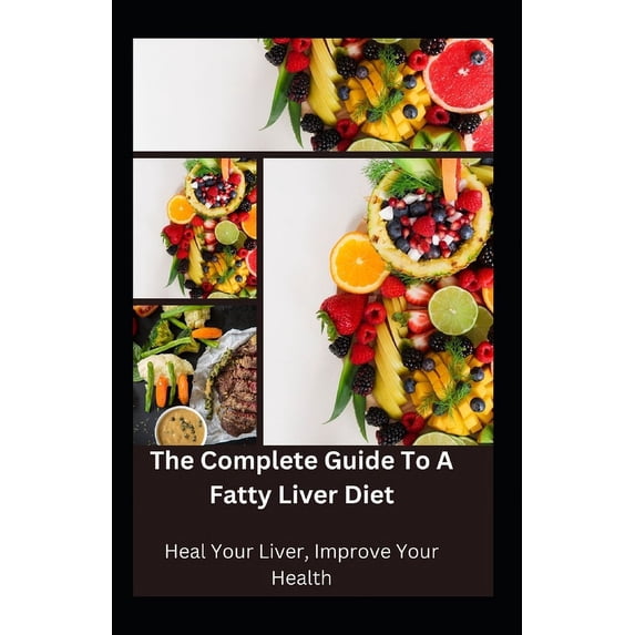 The Complete Guide to a Fatty Liver Diet (Paperback)