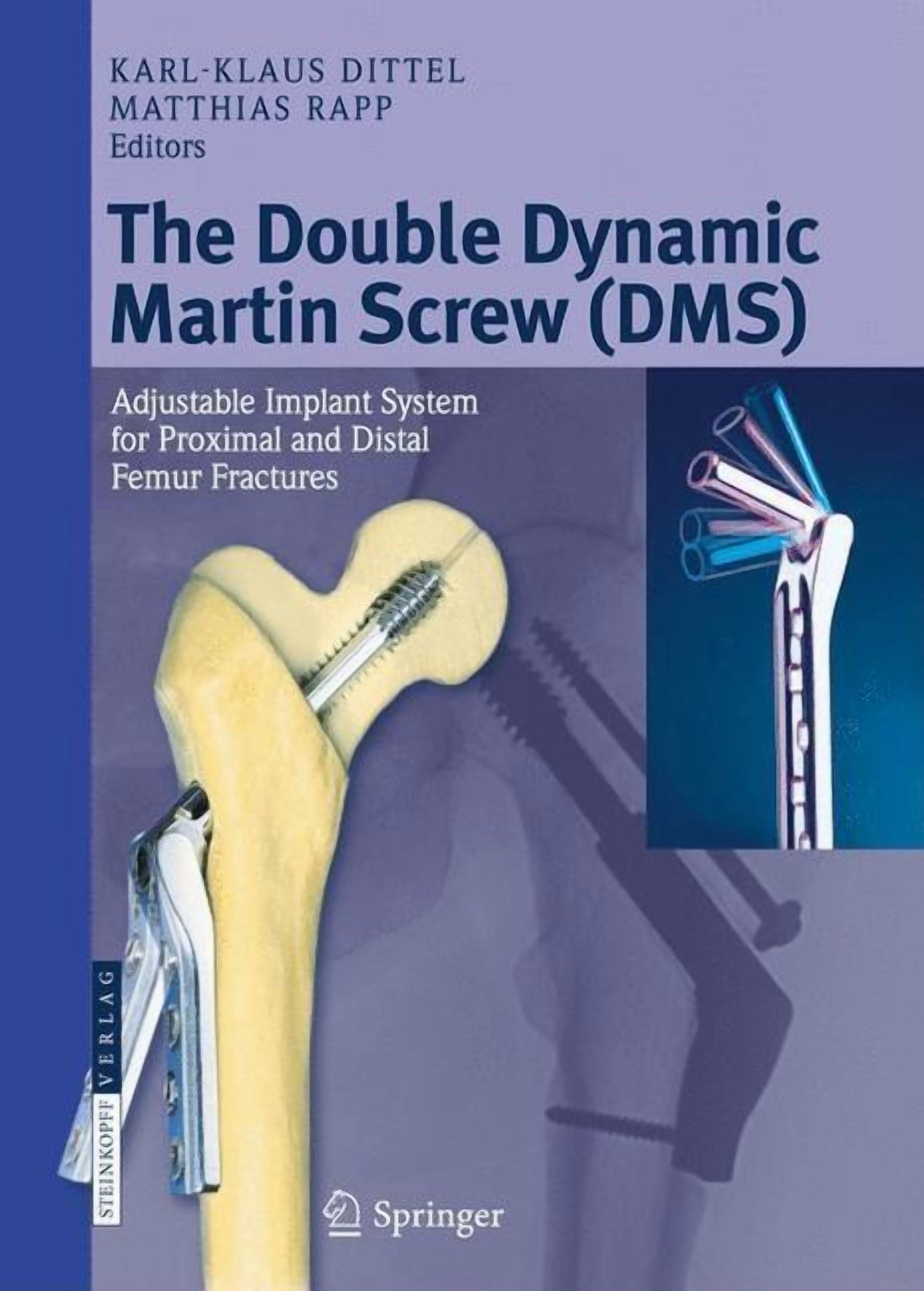 The Double Dynamic Martin Screw (DMS): Adjustable Implant System for ...