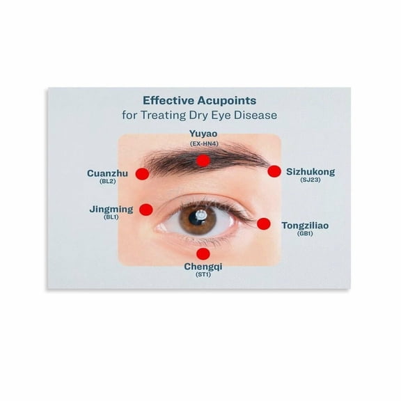 The Facts on Dry Eye Poster Eye Hospital Wall Decorate (7) Canvas Painting Posters And Prints Wall Art Pictures for Living Room Bedroom Decor