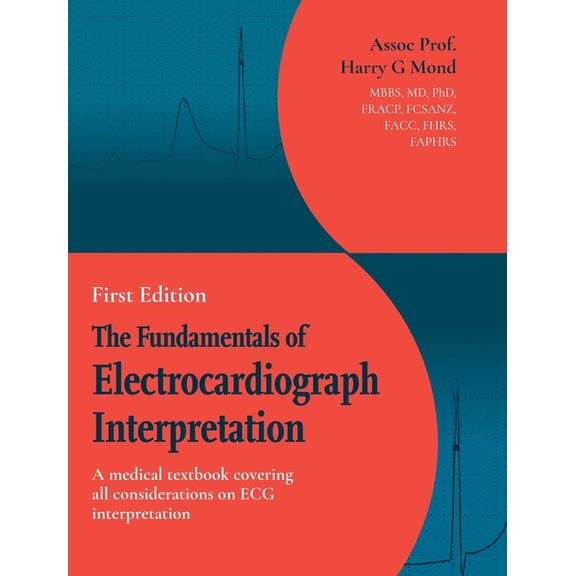 The Fundamentals of Electrocardiograph Interpretation: A medial textbook covering all considerations on ECG interpretati, (Hardcover)