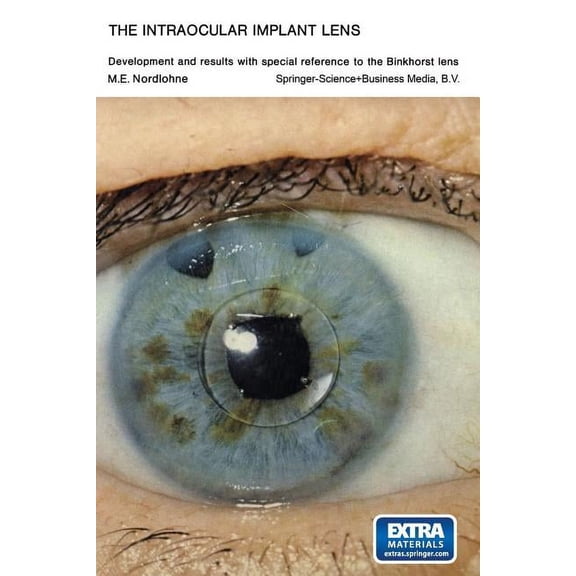 The Intraocular Implant Lens Development and Results with Special Reference to the Binkhorst Lens: Proefschrift, (Paperback)