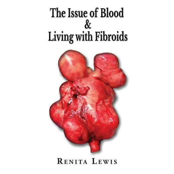 The Issue Of Blood & Living with Fibroids, (Paperback)