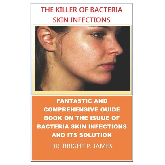 The Killer of Bacteria Skin Infection. : A Comprehensive Book on Bacteria Skin Infections and the Solution to It. (Paperback)