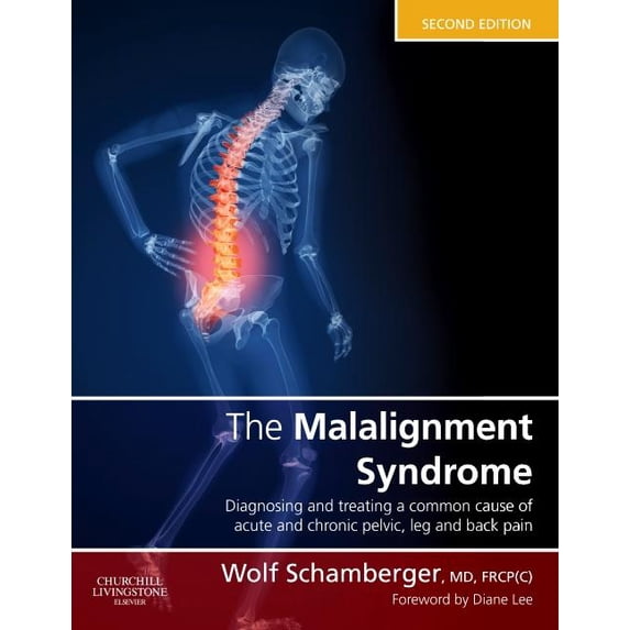 The Malalignment Syndrome: Diagnosis and Treatment of Common Pelvic and Back Pain, (Hardcover)