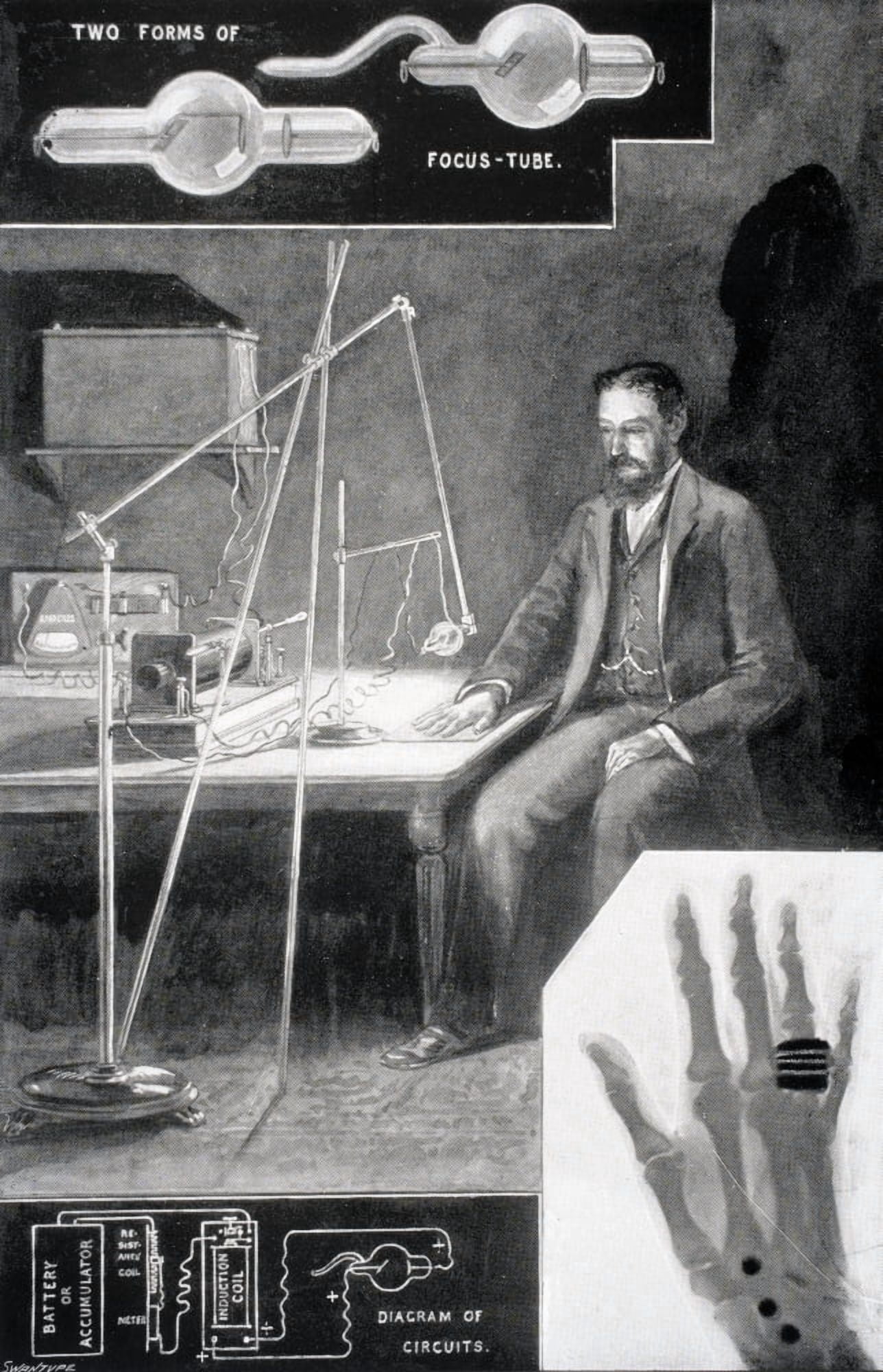 The New Photography Or X Ray Photography From The Modern Cyclopedia Vol Vi 1903 Canvas Art - Ken Welsh Design Pics (22 x 36)