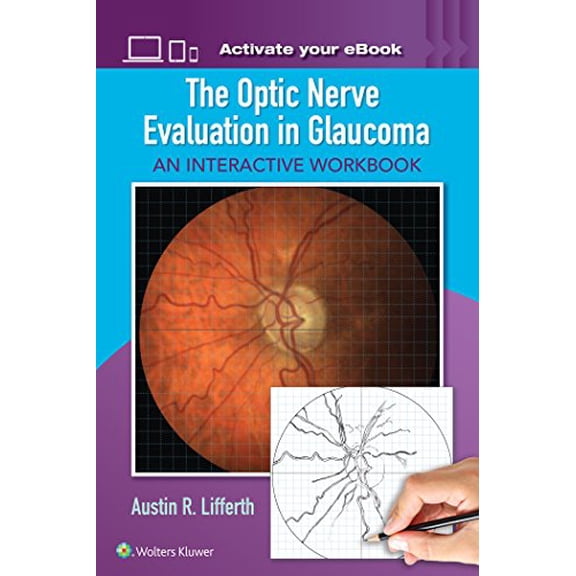 Pre-Owned The Optic Nerve Evaluation in Glaucoma: An Interactive Workbook, (Paperback)