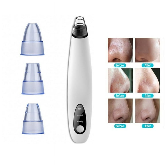 The Perfect Part Electric Portable Face Cleaner Blackhead Extractor Pore Vacuum Suction For Face
