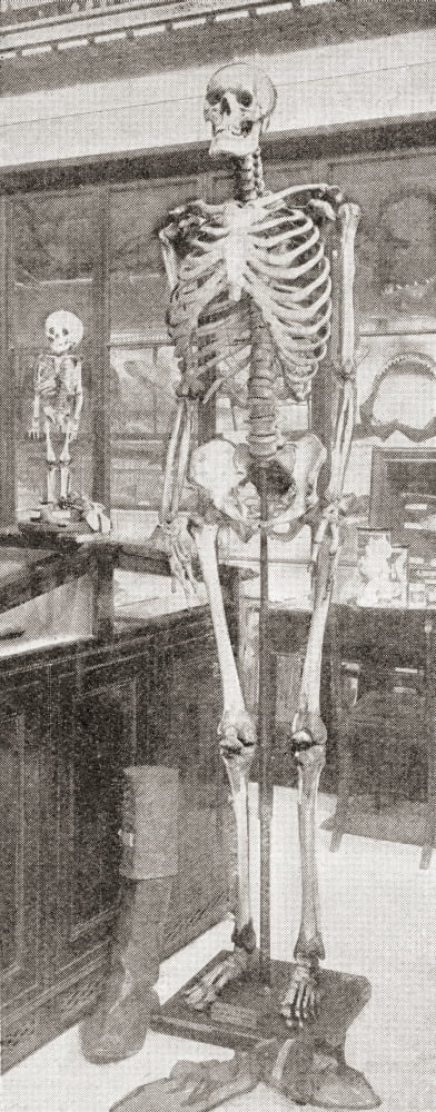 The Skeletons Of Charles Byrne 1761 Canvas Art - Ken Welsh Design Pics (12 x 30)