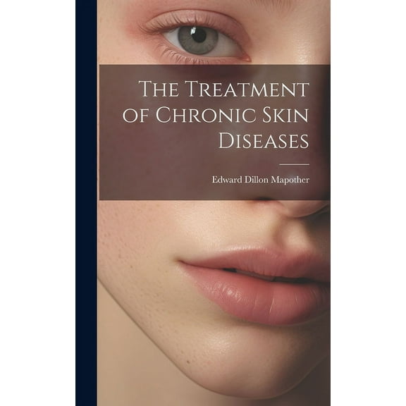 The Treatment of Chronic Skin Diseases (Hardcover)