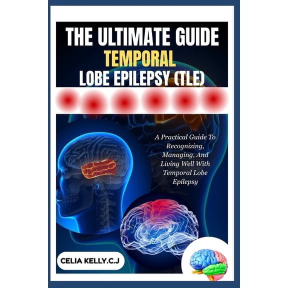 The Ultimate Guide Temporal Lobe Epilepsy (Tle): A Practical Guide To Recognizing, Managing, And Living Well With Tempor, (Paperback)