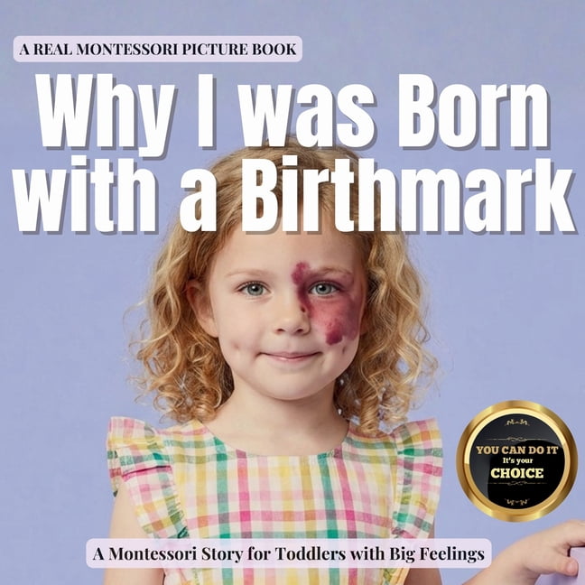 The Whole Brain Toddler Why I was Born with a Birthmark: A calm ...