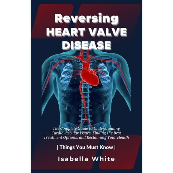 Things You Must Know: Reversing Heart Valve Disease: The Complete Guide to Understanding Cardiovascular Issues, Finding the Best Treatment Options, and Reclaiming Your Health Things You Must Know (Pap