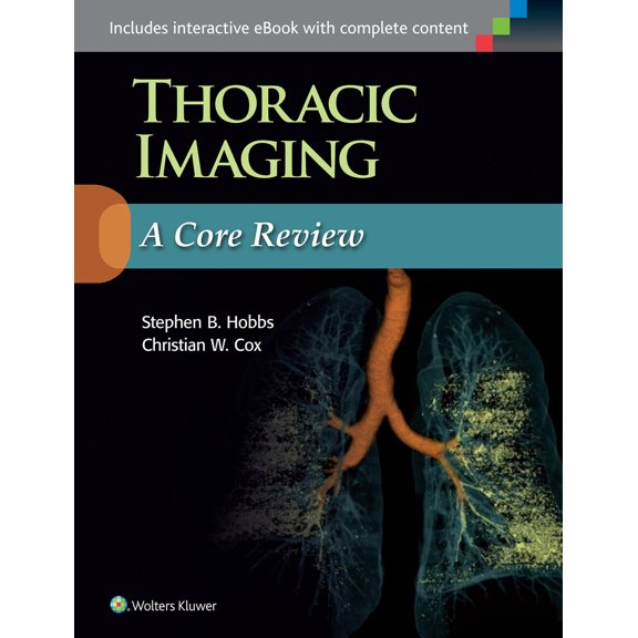 Pre-Owned Thoracic Imaging: A Core Review (Paperback) 149634748X 9781496347480
