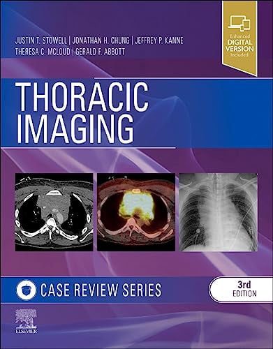 Pre-Owned Thoracic Imaging: Case Review [Paperback] Stowell MD, Justin ...