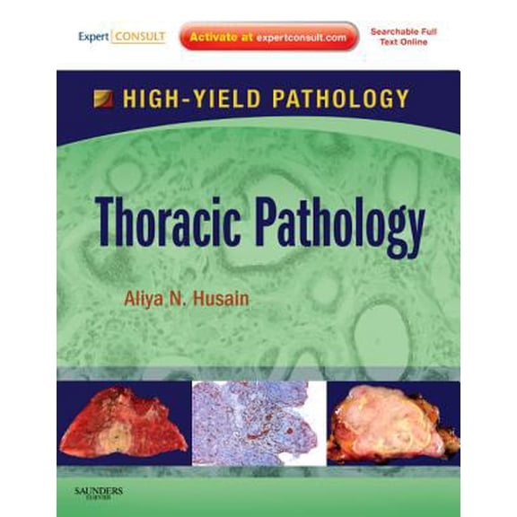 Pre-Owned Thoracic Pathology: Expert Consult
