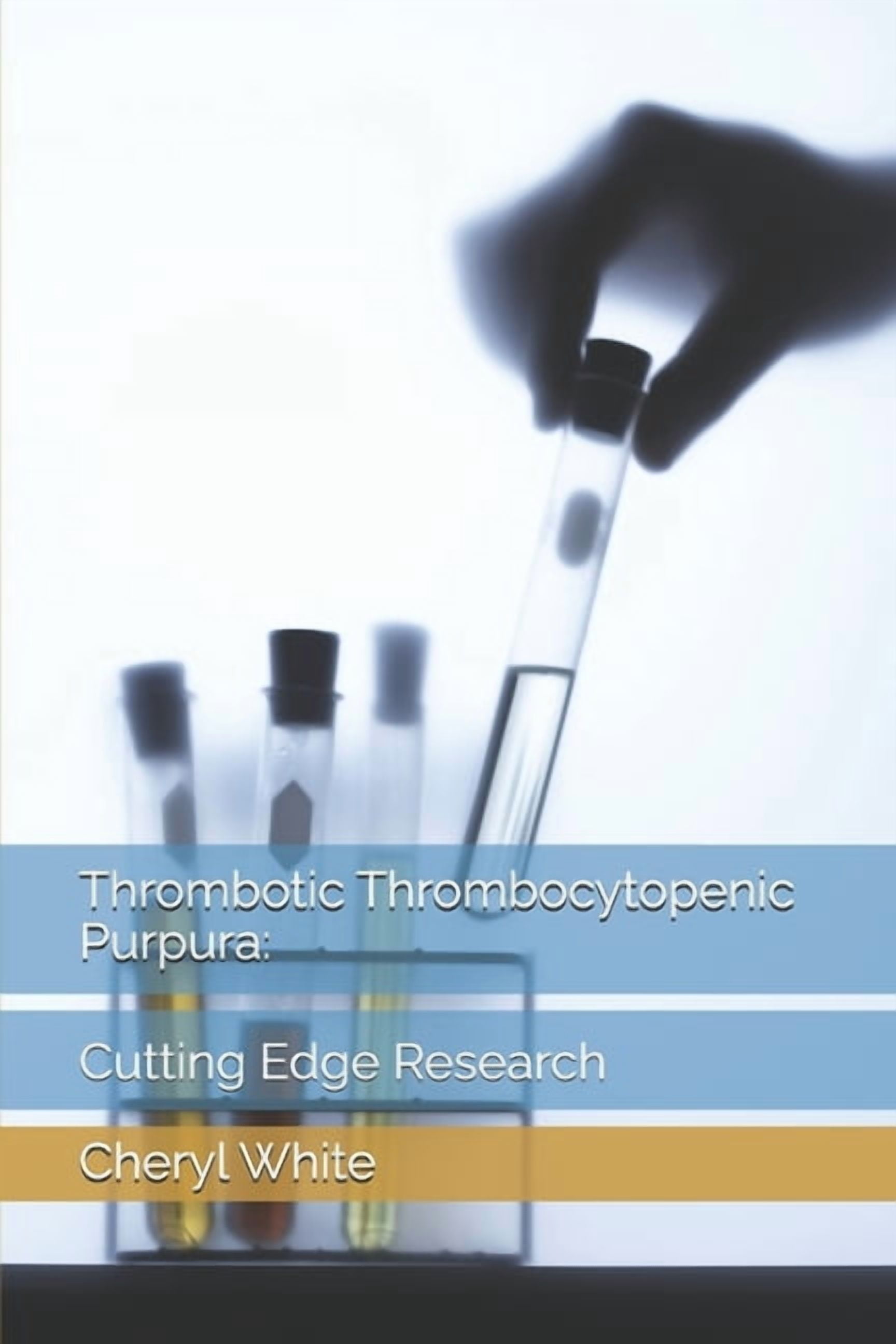 Thrombotic Thrombocytopenic Purpura: Cutting Edge Research, (Paperback)