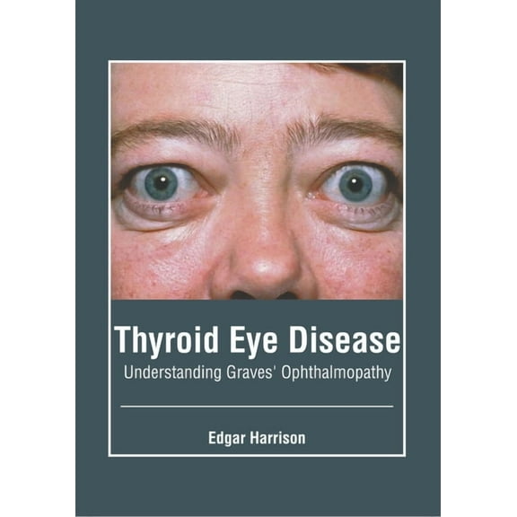Thyroid Eye Disease: Understanding Graves' Ophthalmopathy, (Hardcover)