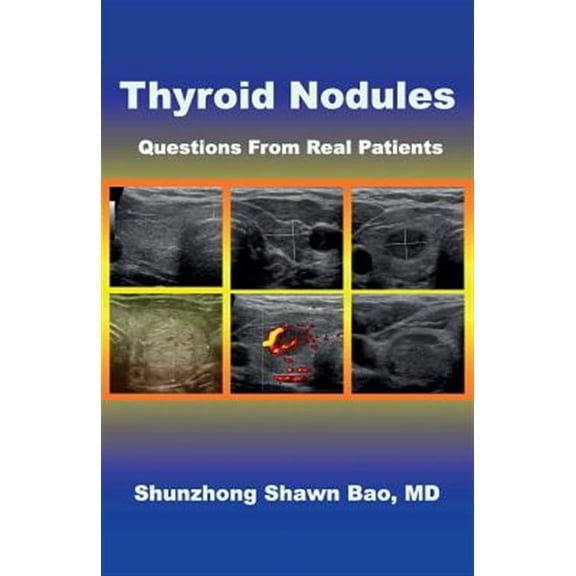 Thyroid Nodules: Questions from Real Patients