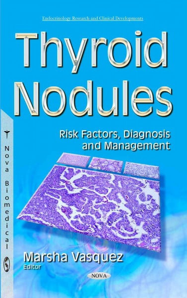 Thyroid Nodules : Risk Factors, Diagnosis and Management - Walmart.com