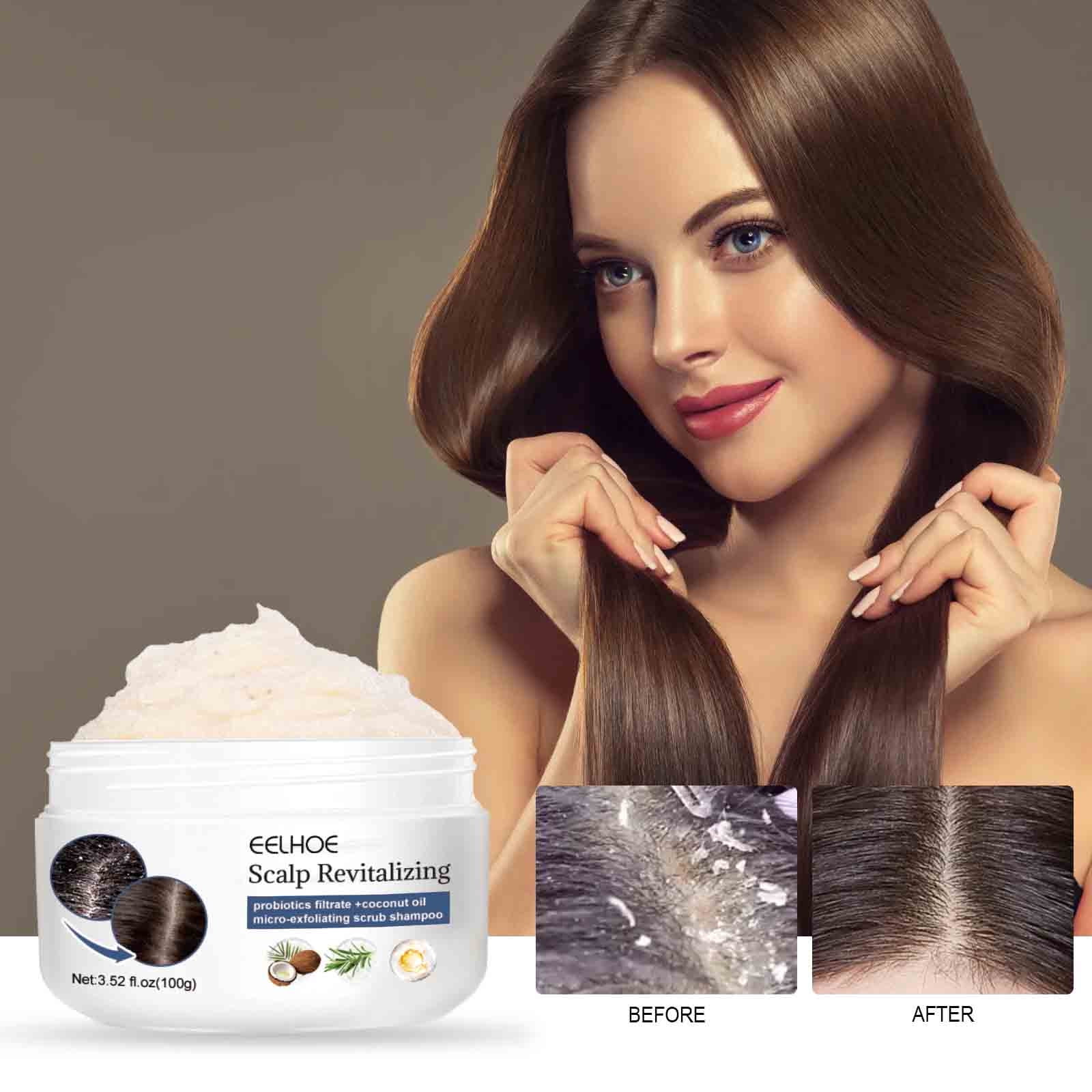 Time and Tru Personal Care Clearance Sulfur Shampoo for Removing Lice