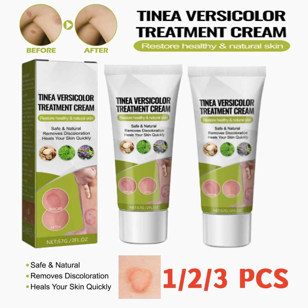 Tinea Versicolor Treatment Cream Body Antifungal Gel for Tinea