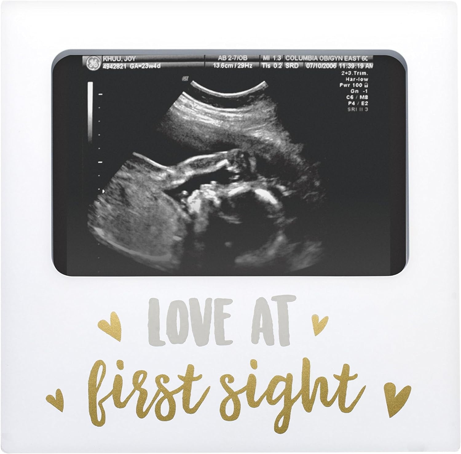 Pregnancy/Maternity Ultrasound And Photo Album/Keepsake 