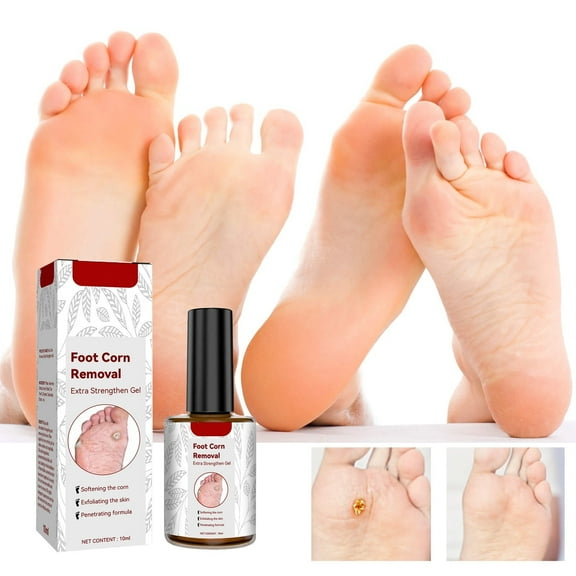 Tkrady Foot Corn Removal Extra Strengthen Gel, Liquid Corn and Callus Remover, Corn Remover Gel for Feet, Corn Removers for Toes Extra Strength 10ml