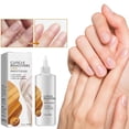 thumbnail image 1 of Tkrady Instant Cuticle Remover Gel, Nail Cuticle Softener, Professional Pedicure & Manicure Nail Cuticle Repair Care Treatment Spray, Instantly Remove Dead Skin, 1 of 5