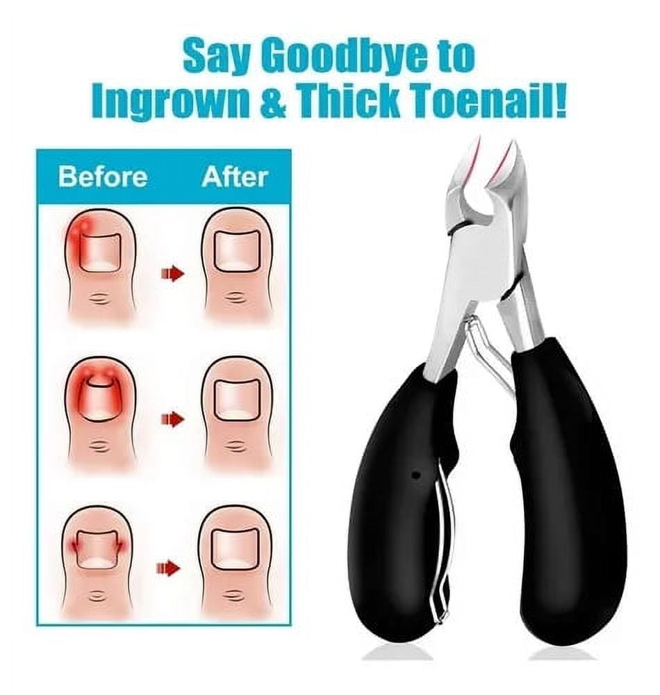 Toe Nail Clipper for Ingrown or Thick Toenails,Toenails Trimmer and