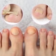 thumbnail image 1 of Toe Nail Sticker, 1 of 5