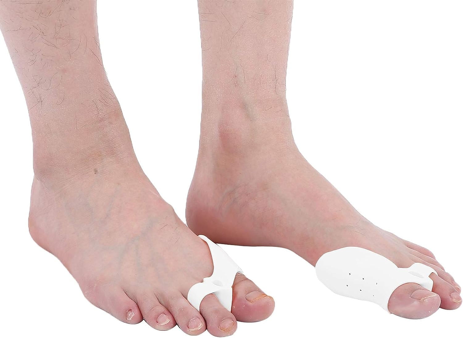 Toe Separators for Overlapping Toes, 10 Pairs Toe Valgus Corrector