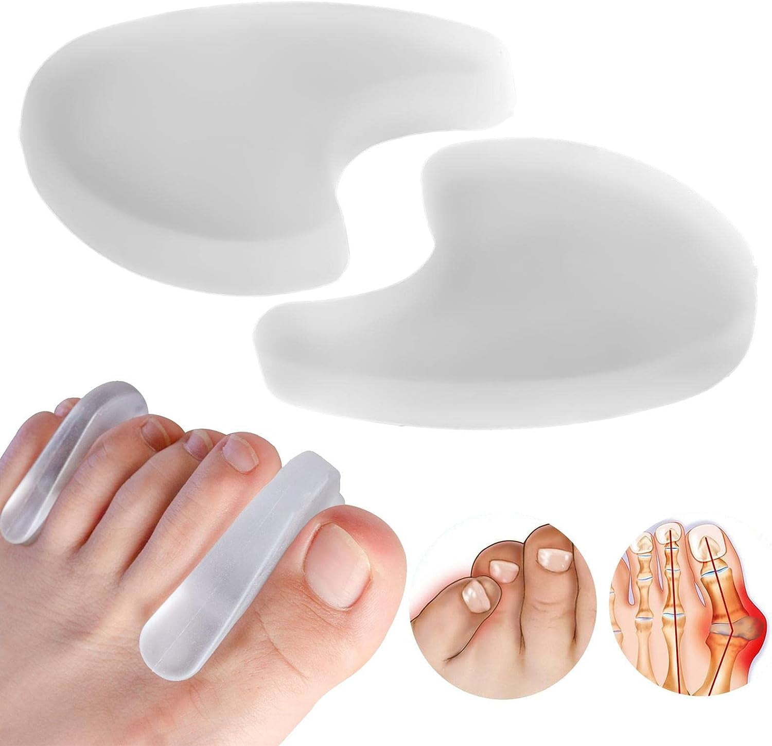 Toe Spacers Toe Fixer for Feet,Gel Toe Separators for Overlapping Toes, Big Toe Alignment
