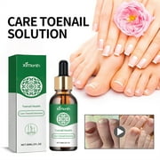 Toenail Care Solution Hand, Foot And Nail Repair Brightening Nails Onychomycosis Soft Nail Inlay Toenail Care Solution