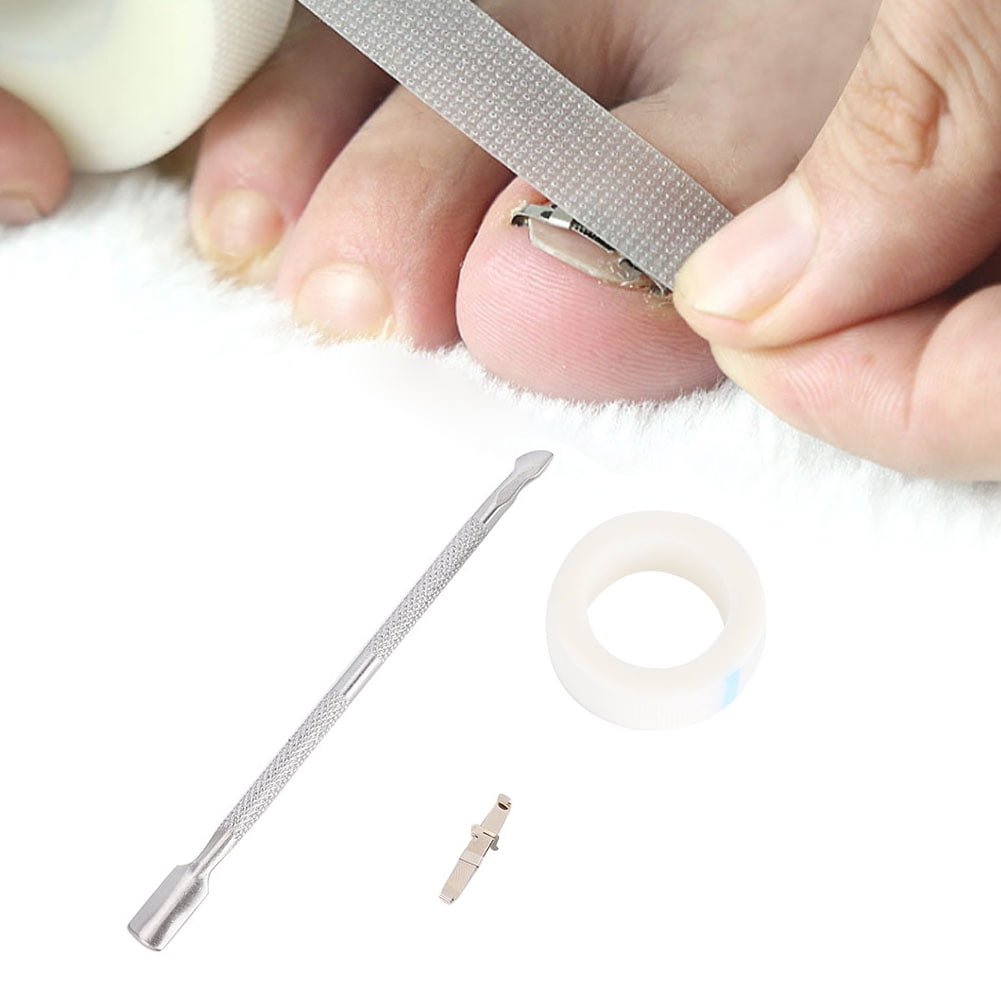 Toenail Corrector Sticker, Ingrown Toenail Tools, Ingrown Toenail