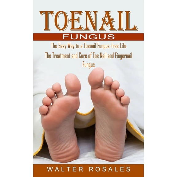 Toenail Fungus: The Easy Way to a Toenail Fungus-free Life (The Treatment and Cure of Toe Nail and Fingernail Fungus), (Paperback)