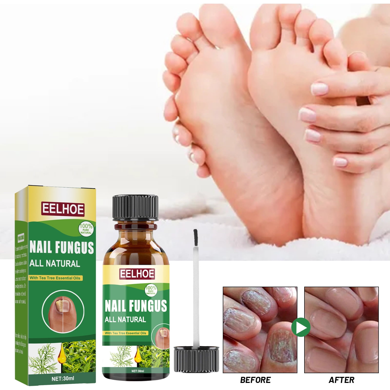 Toenail Fungus Treatment, Effective Nail Fungus Treatment for Toenail
