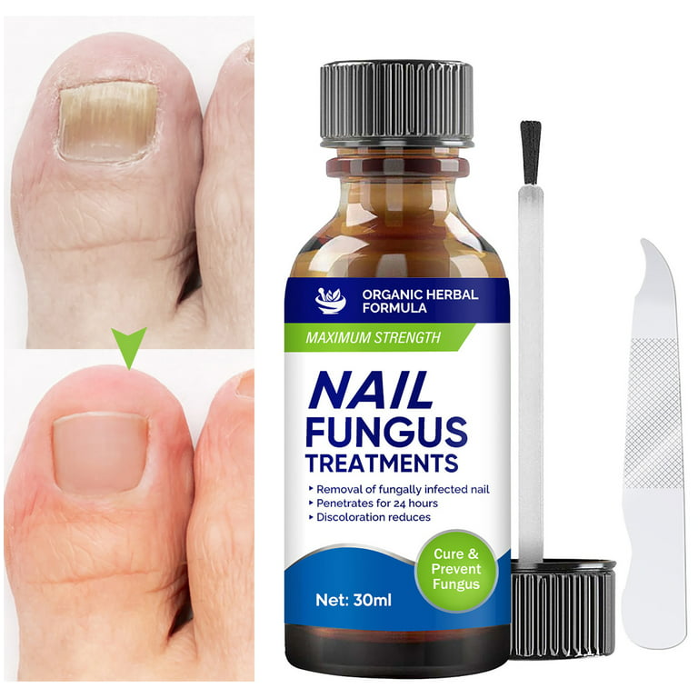 Try this life-changing product for thick toenails: Central