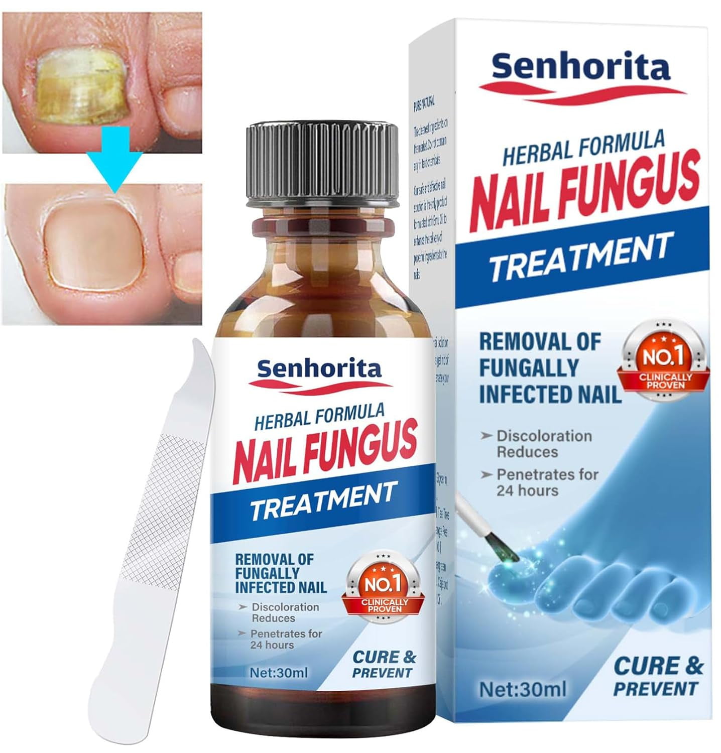 Toenail Fungus Treatment, Extra Strength Nail Repair Liquid for Toenail ...