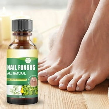Toenail Fungus Treatment, Extra Strength Tea Tree Oil Nail Fungus Treatment for Toenail, Nail Repair for Damaged, Broken, Cracked & Discolored Nails 30ML, 1PCS