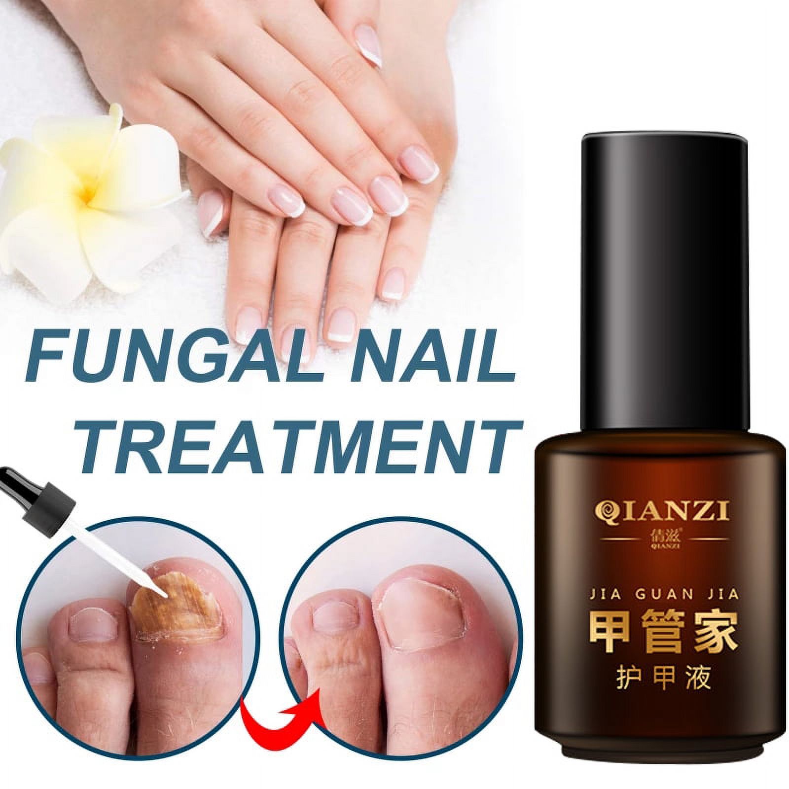Toenail Fungus Treatment Liquid for Remove Onychomycosis & Protects