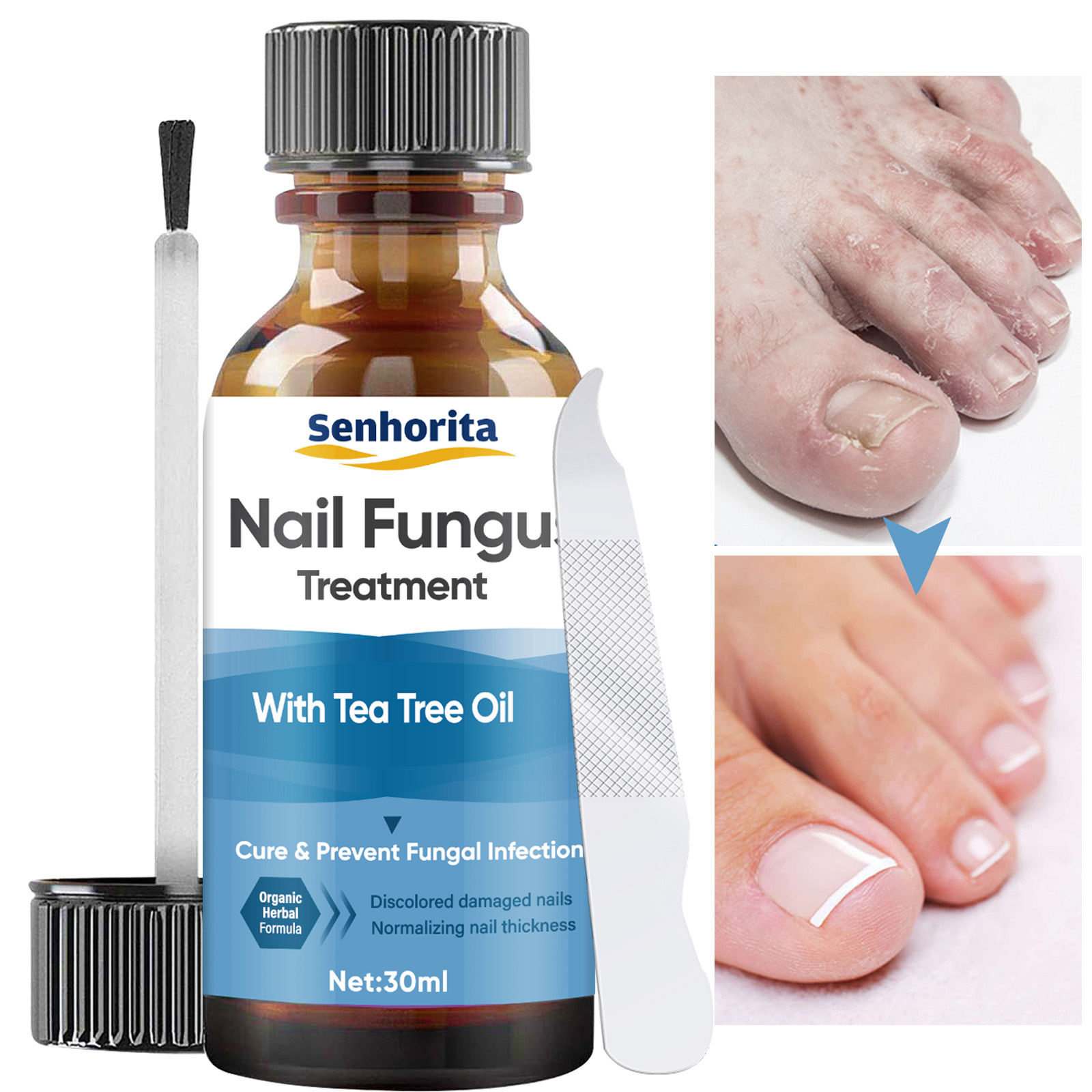 Dr. Luke Nail Fungus Treatment Liquid for Toenail, Maximum Strength